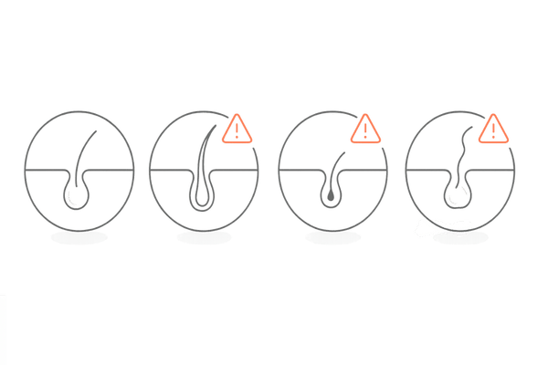 危険な抜け毛の見分け方（毛根の形と色のアイコン）