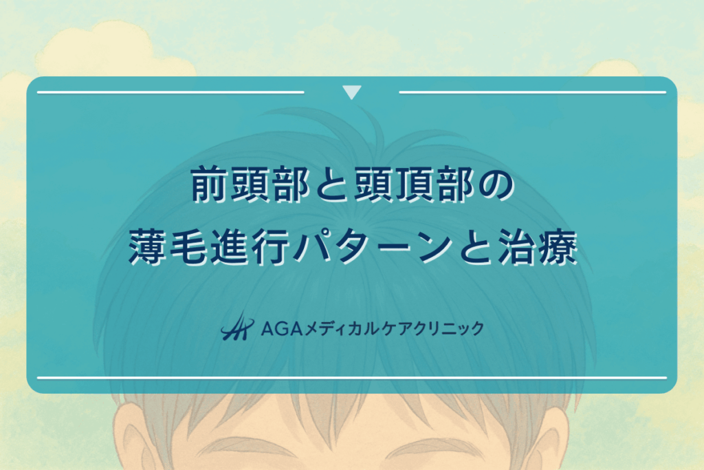 前頭部と頭頂部の薄毛進行パターンと治療