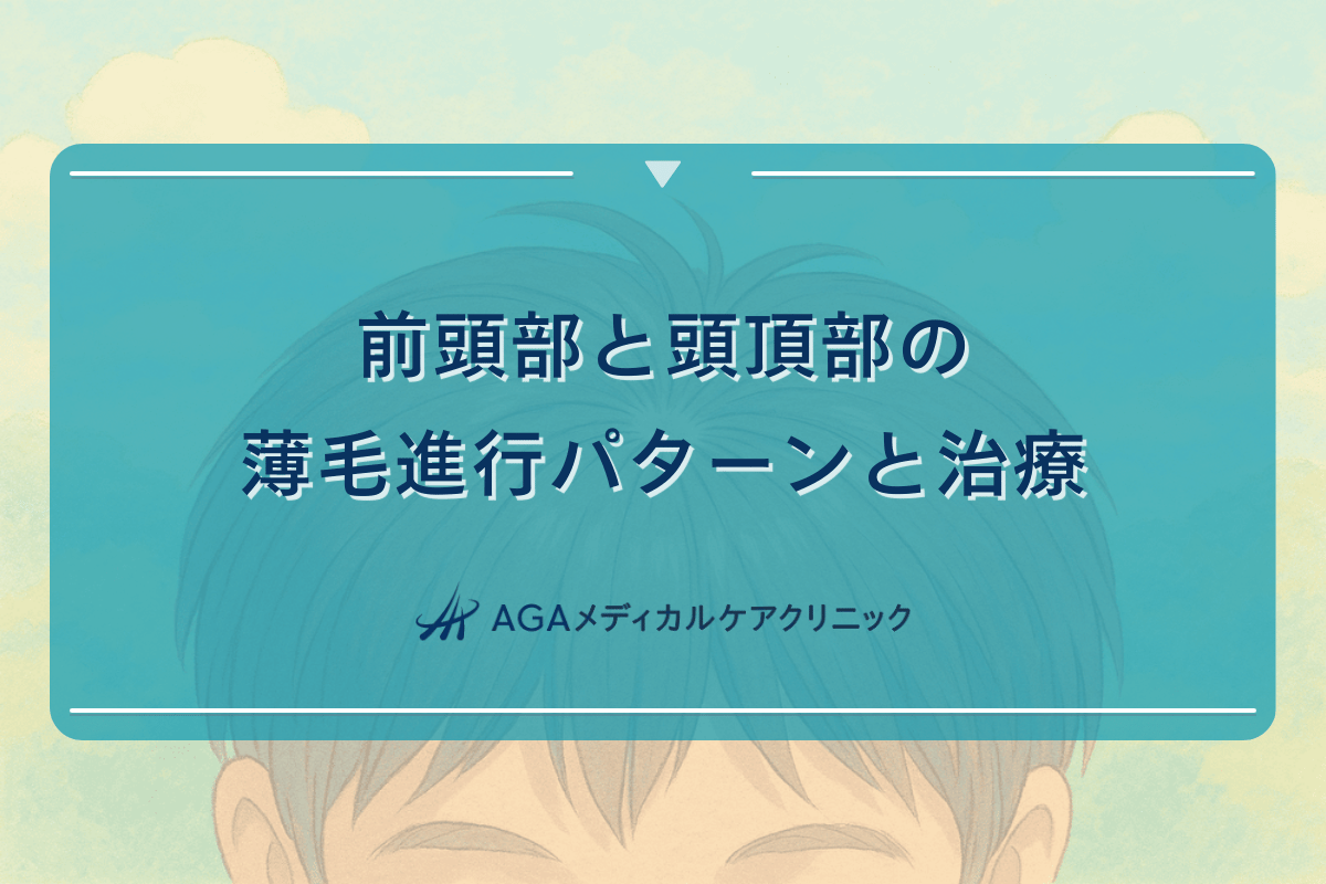 前頭部と頭頂部の薄毛進行パターンと治療