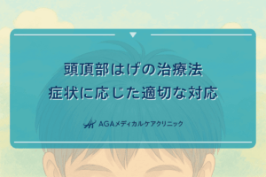 頭頂部はげの治療法｜症状に応じた適切な対応
