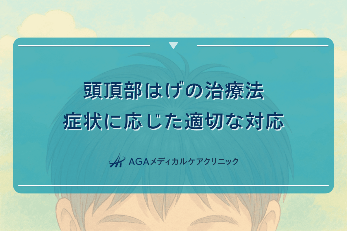 頭頂部はげの治療法｜症状に応じた適切な対応