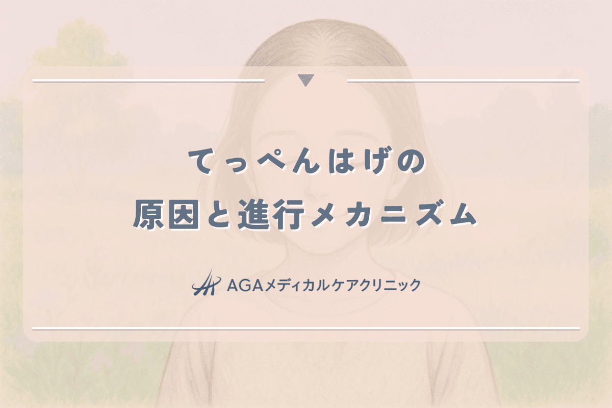 てっぺんはげの原因と進行メカニズム｜女性に多い頭頂部薄毛の特徴
