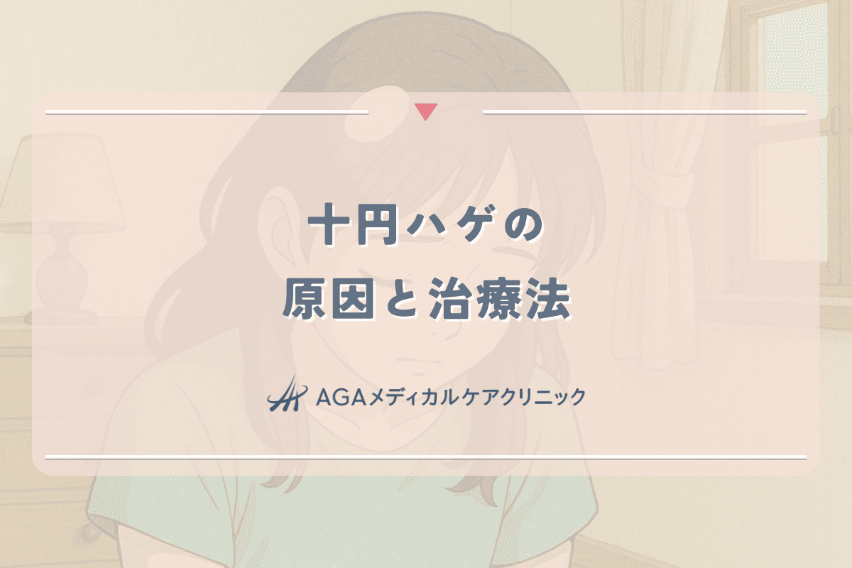 十円ハゲの原因と治療法｜女性の円形脱毛症について