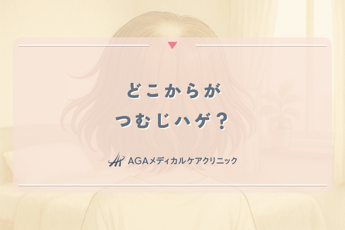どこからがつむじハゲ？女性が知っておくべき進行パターンと基準