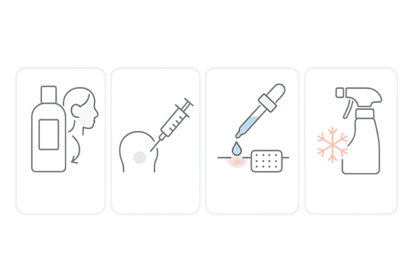 女性の円形脱毛症の治療オプション｜ステロイド外用・局所注射・局所免疫療法・冷却療法の4カード比較