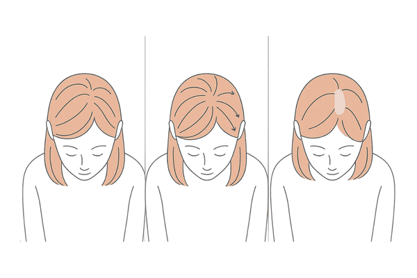 女性のつむじの位置と毛流の仕組み|頭頂部で地肌が見えやすい理由(イメージ図)