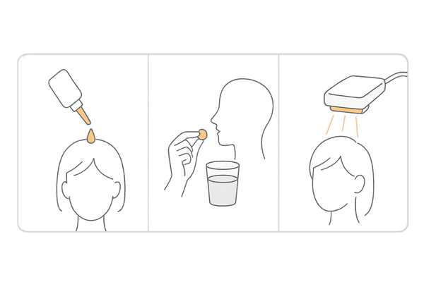 女性のつむじハゲ治療の選択肢|外用薬・内服薬・注入/光治療(イメージ)