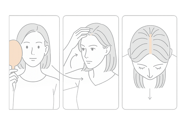 女性の前髪薄毛セルフチェック|生え際・M字・分け目の確認イラスト