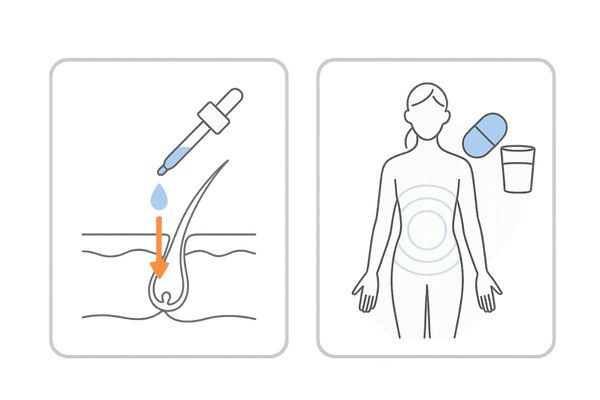女性の薄毛治療における外用薬と内服薬の違い（作用範囲と使い方のイメージ
