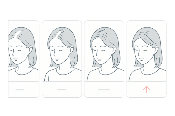 女性の薄毛が治るイメージ｜進行度と回復の目標（4段階図）
