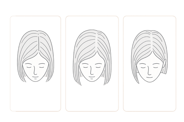 女性の薄毛の進行パターン比較|びまん性・分け目拡大・正常の違い