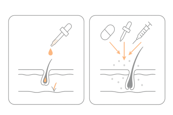 内服薬・外用薬・メソセラピー併用による相乗効果の概念図(女性の薄毛治療)
