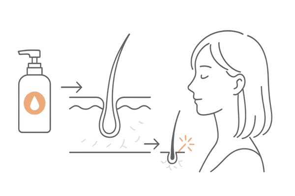 女性の抜け毛リスク:洗浄力が強すぎるシャンプーで皮脂バリアが低下し炎症につながる流れ(頭皮断面図)