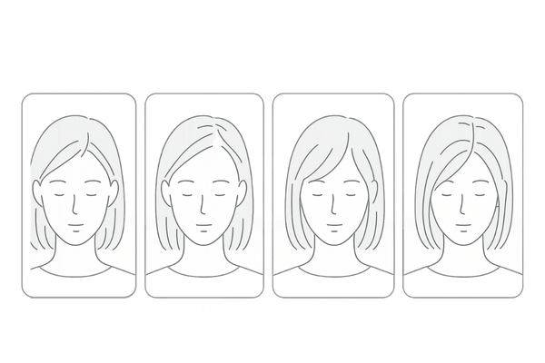 女性の前髪薄毛の初期サイン比較|生え際後退・ボリューム低下・分け目拡大の例