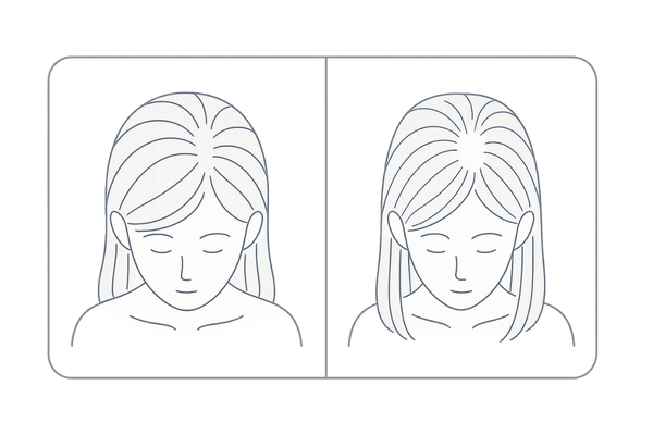 女性のつむじ薄毛の特徴|正常なつむじとの比較イラスト