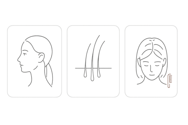 女性のおでこ・生え際の薄毛セルフチェック図解(初期サイン:額の拡大・毛の細化・分け目の拡大)