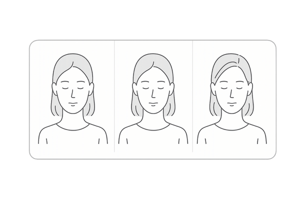 女性の薄毛の種類比較｜びまん性・FAGA・分娩後脱毛症を図解