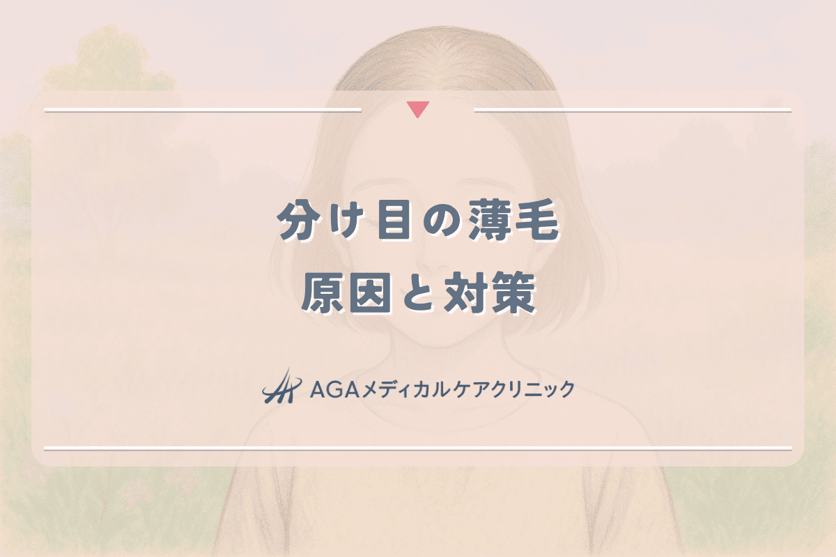 分け目の薄毛に悩む女性のための原因と対策｜目立たなくする方法