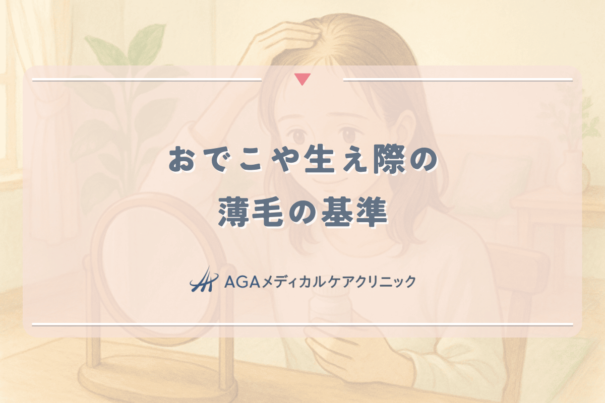 おでこや生え際の薄毛の基準と早期発見のポイント