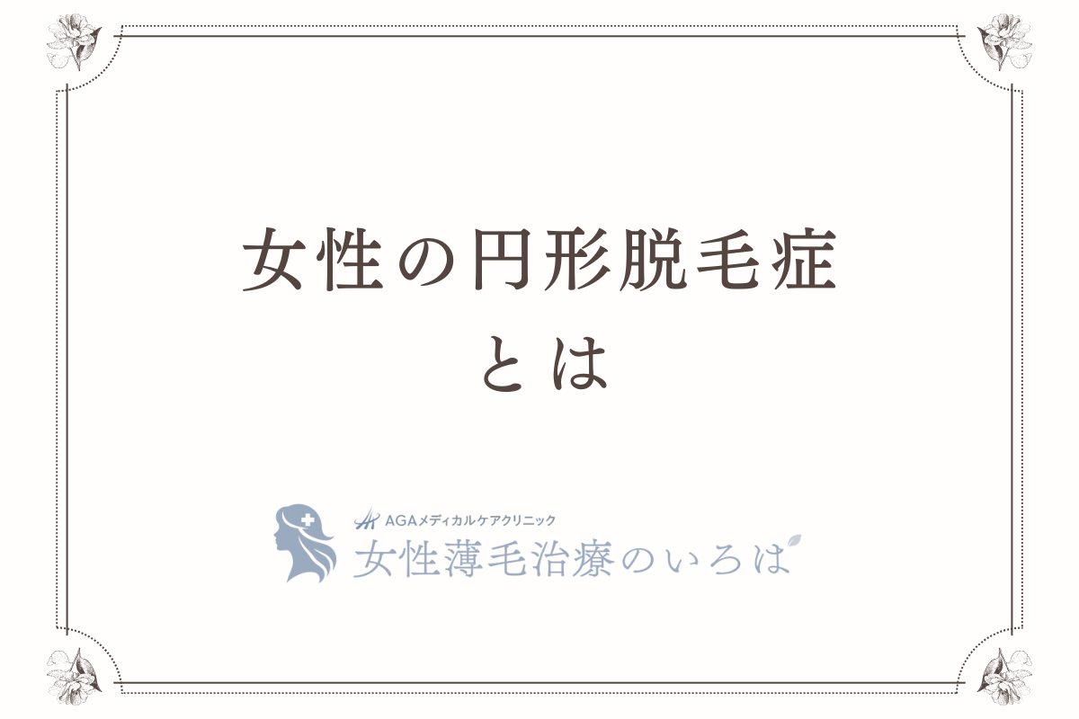女性の円形脱毛症とは