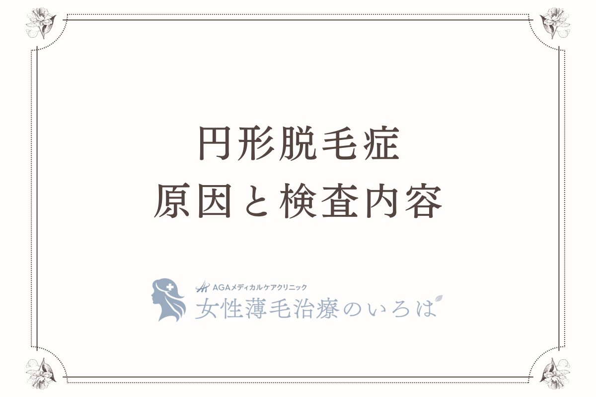 円形脱毛症の原因と検査内容