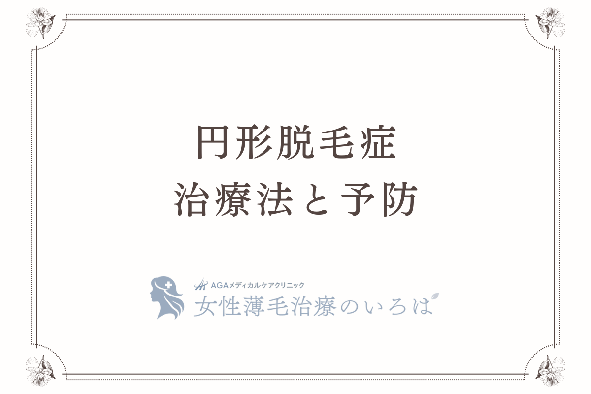 円形脱毛症の治療法と予防