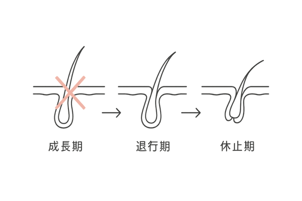 ヘアサイクルと抗がん剤の影響