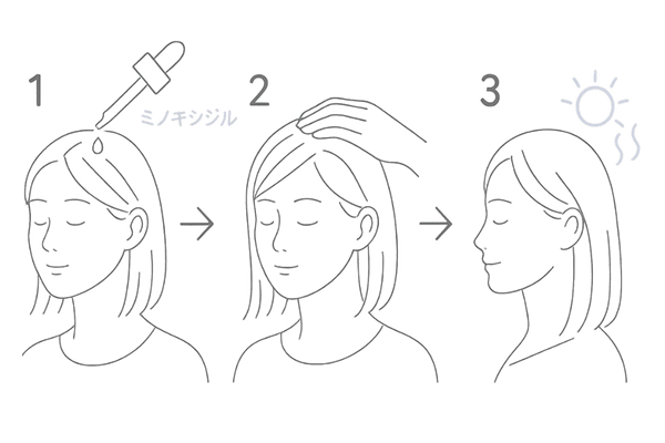 ミノキシジルを頭皮に正しく塗布するステップイラスト