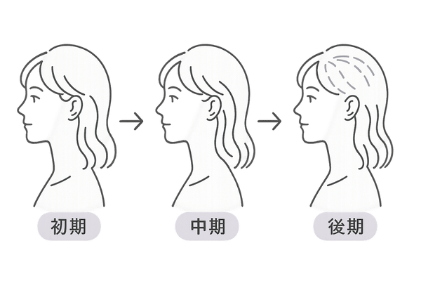 FAGA初期・中期・後期の頭部変化
