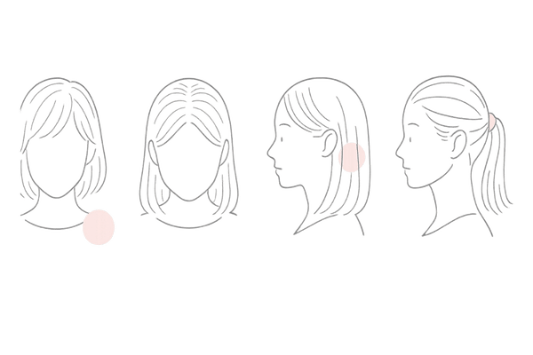 女性の脱毛症タイプ比較イラスト（びまん性・FAGA・円形・牽引性）