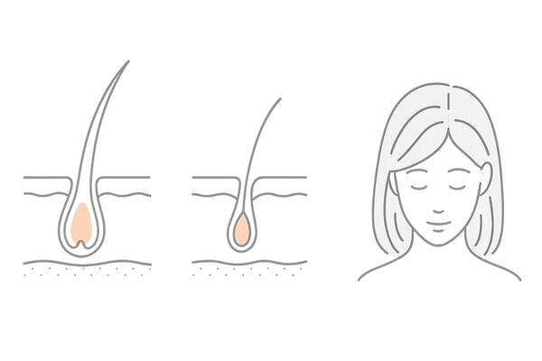 女性の薄毛とエストロゲン｜ヘアサイクル（成長期維持）の図解