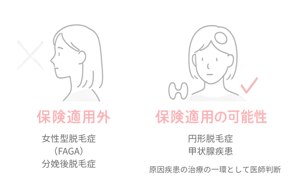 薄毛治療の保険適用可否の早見図|適用外と例外ケース