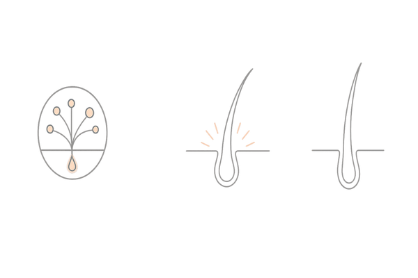 ミノキシジル外用薬の作用を図解（血行促進・毛母細胞活性化・成長期延長）