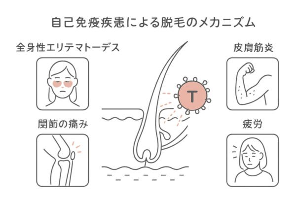 膠原病に伴う脱毛の仕組み