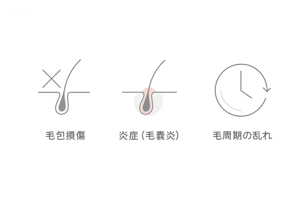 白髪を抜くと起こる頭皮トラブル|毛包損傷・毛嚢炎・毛周期の乱れの注意図