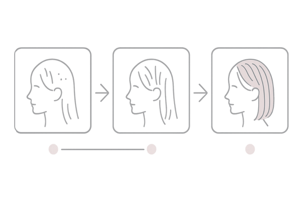 発毛促進薬の効果のタイムライン図｜1～3ヶ月・3～6ヶ月・6ヶ月以降の変化イメージ