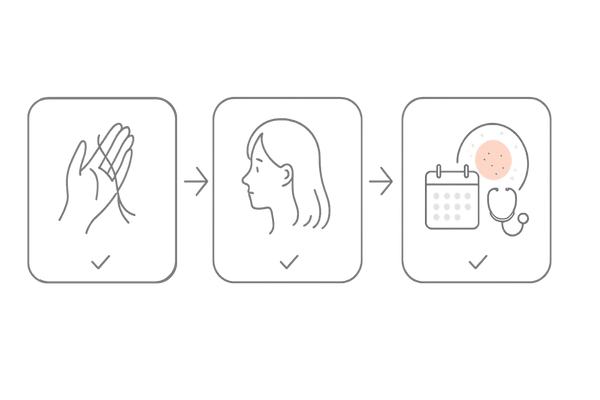 女性の抜け毛セルフチェック4ステップと受診目安のフロー図