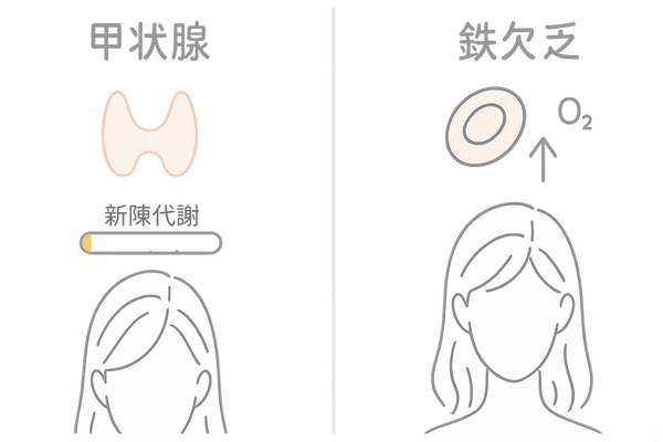 甲状腺機能低下症と鉄欠乏性貧血―女性の抜け毛に関わる全身疾患の比較図