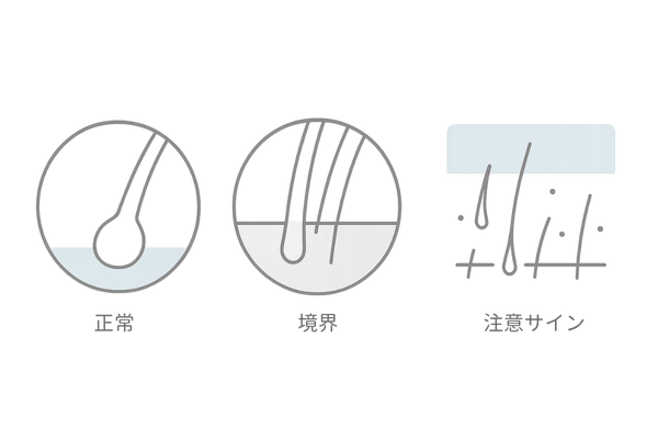 思春期・高校生の抜け毛｜正常と注意サインの見分け方イラスト