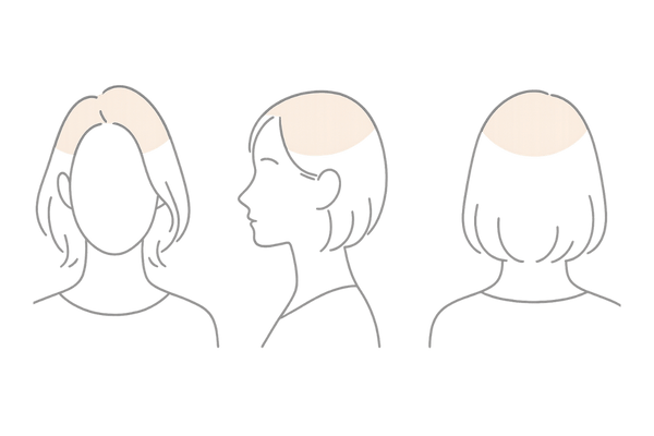 40代女性の薄毛を自然にカバーする「ひし形シルエット」の基本(前・横・後ろの立体感)
