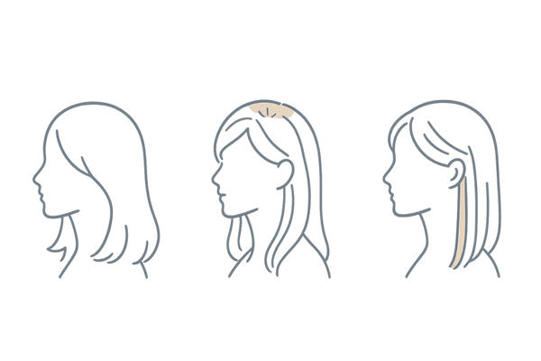 女性の薄毛対策｜フルウィッグ・部分ウィッグ・エクステの違い図解