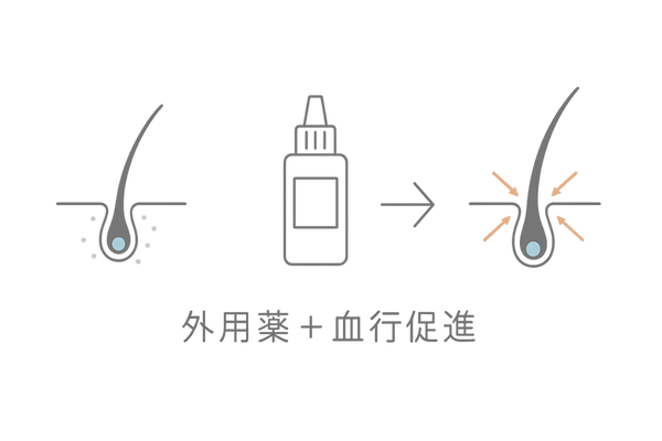 頭皮血行を促す外用薬治療フロー図