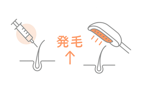メソセラピーとLED照射の頭皮ダブルアプローチ図