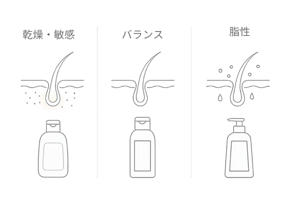 頭皮タイプ別セルフチェック：乾燥・敏感／バランス／脂性と最適なシャンプー