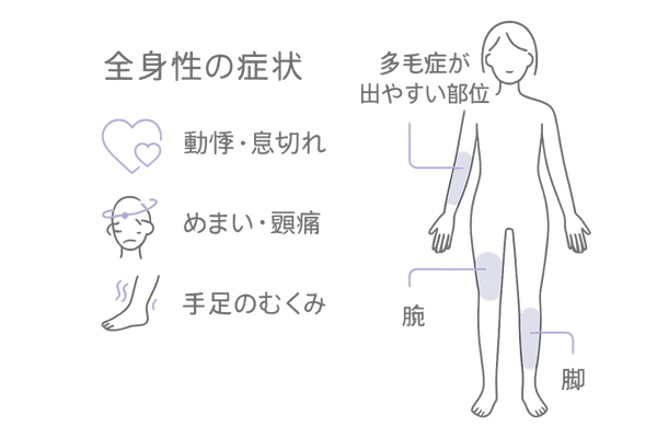 ミノキシジル5mgの主な副作用と注意サイン（女性）｜多毛症・むくみ・動悸