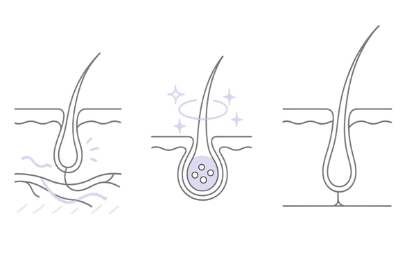 ミノキシジルの作用メカニズム図｜血管拡張・毛母細胞活性・成長期誘導（女性の薄毛/FAGA）