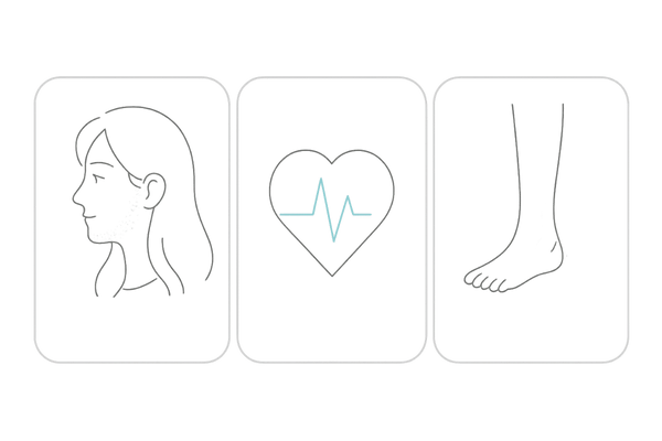 女性が注意すべきミノキシジルタブレットの主要副作用イメージ（多毛・循環器・むくみ）