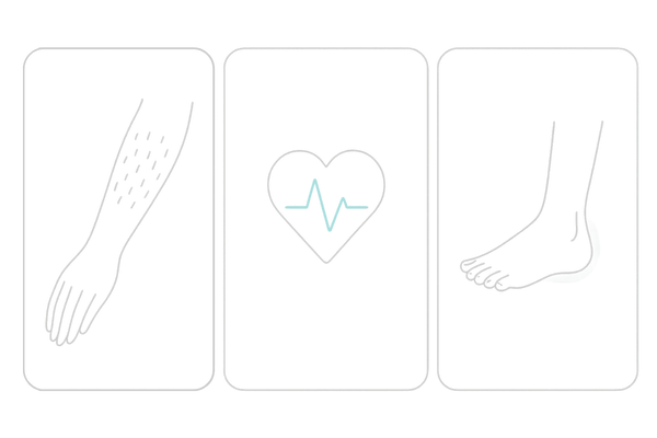 ミノタブの主な副作用の注意ポイント（多毛・動悸/心拍・むくみ）を示す3カード