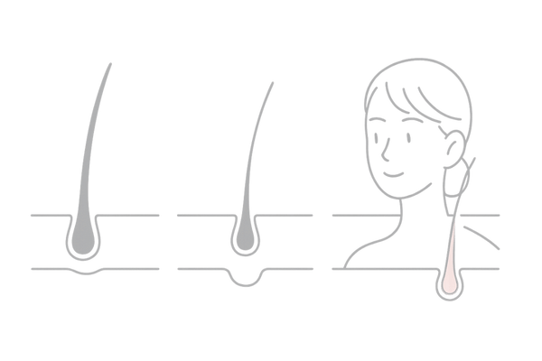 女性薄毛｜ミノキシジル効果を左右するヘアサイクル図解（成長期・退行期・休止期）
