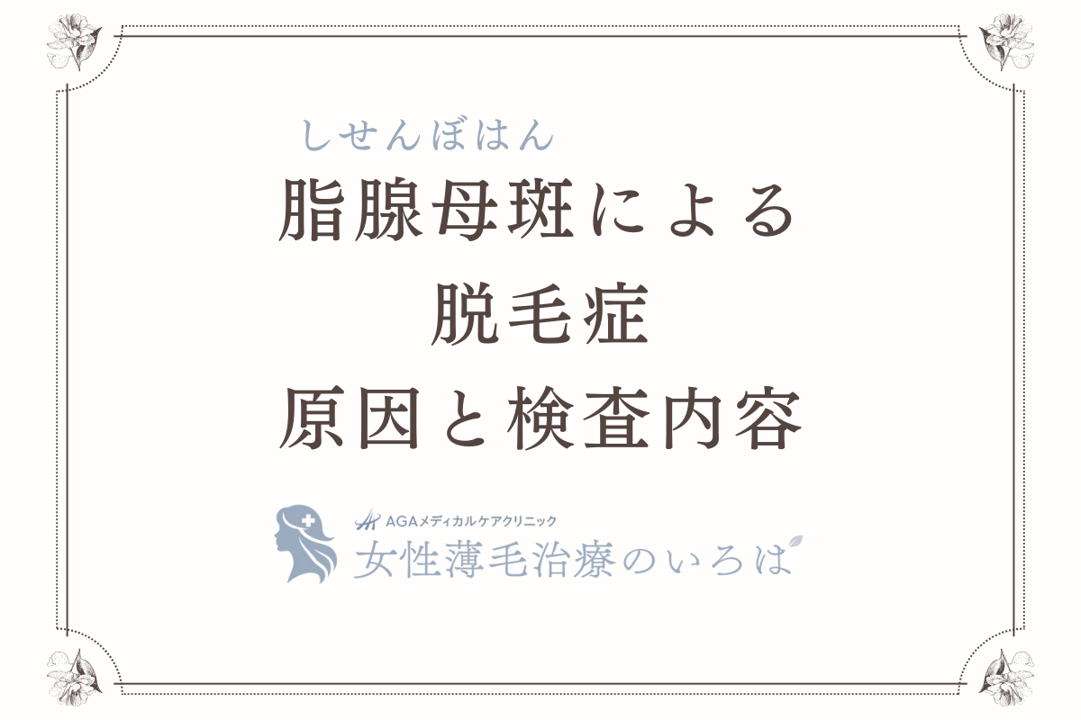 脂腺母斑（しせんぼはん）による脱毛症の原因と検査内容